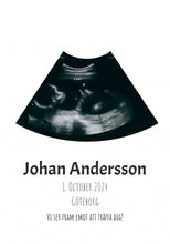 Laddar bild till gallerivisning, Ultraljudsposter Plakana SE